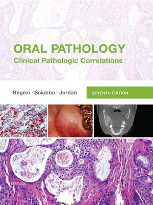 cover image of Oral Pathology--E-Book